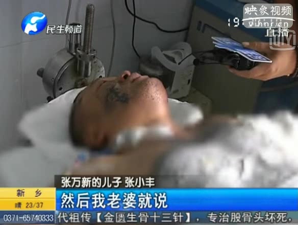 男子腿疼酒精擦拭后打火機(jī)烘干 重度燒傷